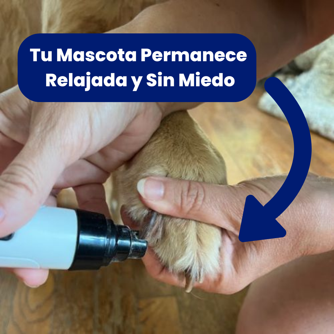 Cortauñas Sin Estrés